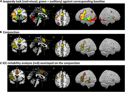 Evaluation of a Simple Clinical Language Paradigm With Respect to Sensory Independency, Functional Asymmetry, and Effective Connectivity